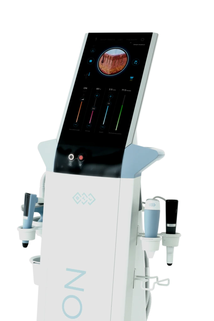 exion slika aparata -frakcioni microneedling - ordinacija Rejuva Beograd